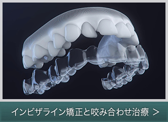 インビザライン矯正と咬み合わせ治療